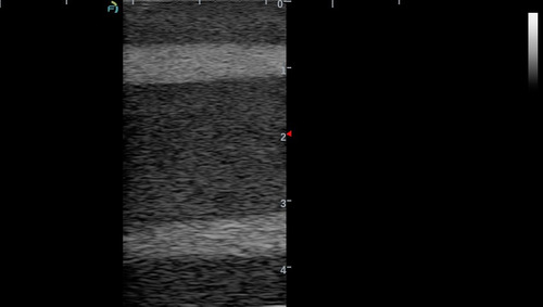 Gphantom Anestesia - Treinamento Guiado Por Ultrassom