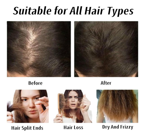 Shampoo Suave E Hidratante - Evita A Queda De Cabelo Em 2 Un