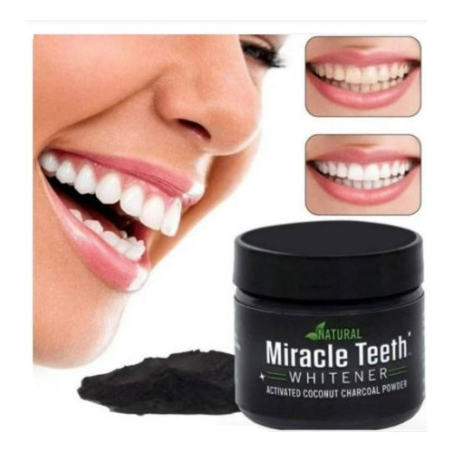 Polvo para blanqueamiento dental Genérica Carbon de 20g