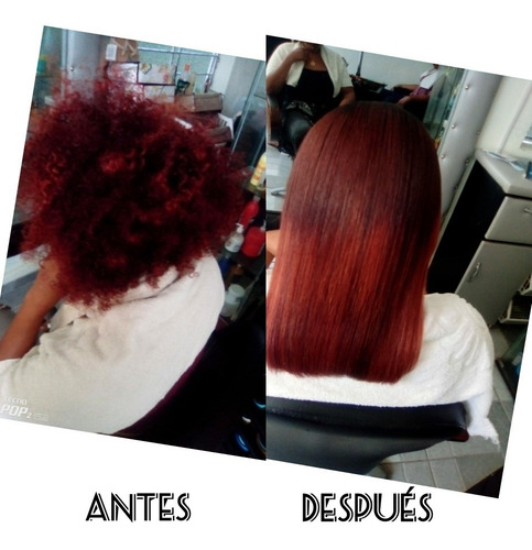 Imagen 1 de 2 de Cirugía Capilar El Mejor Tratamiento Para Tu Cabello