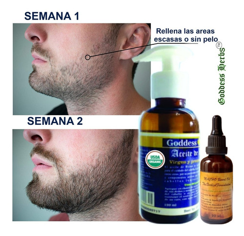 Pack Aceites Para Barba, Estimula Poblacion, Nutre Y Fortale
