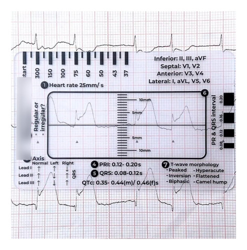Regla 7 Pasos Para Lectura De Ecg Rcp Interpretación