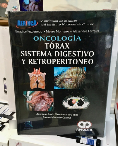 Oncología Tórax Sistema Digestivo Y Retroperitoneo