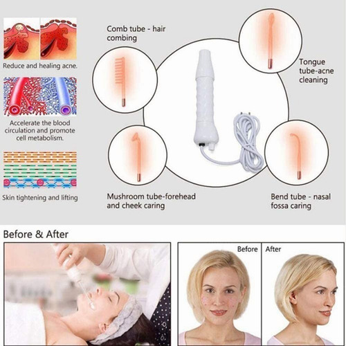 Facial Y Capilar Portátiles De Alta Frecuencia Con 4 Electro