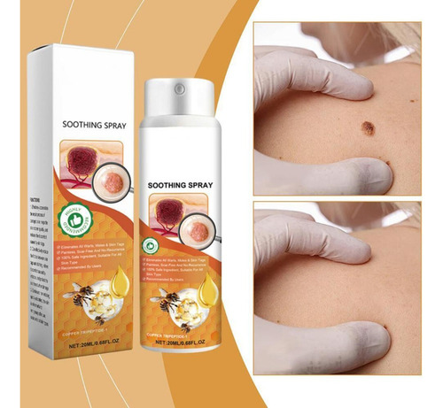 - Tratamiento For Eliminar Verrugas Y Botones En Aerosol Tag