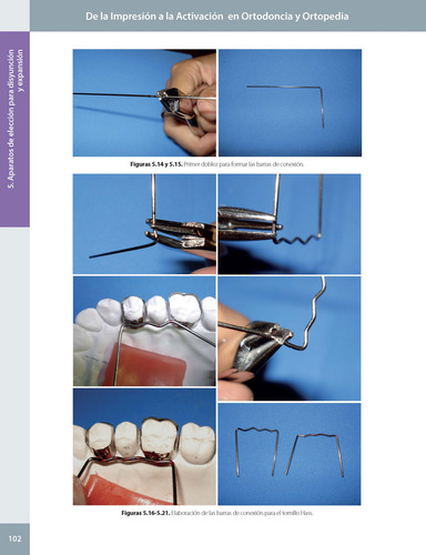 De La Impresión A La Activación En Ortodoncia Y Ortopedia. 2ª Edición. Incluye E-book, De Esequiel Rodríguez., Vol. 1. Editorial Amolca, Tapa Dura, Edición 2 En Español, 2024