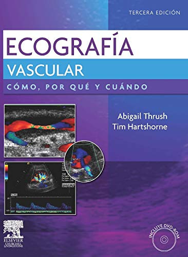 Libro Ecografía Vascular  De Abigail Thrush Tim Hartshorne E