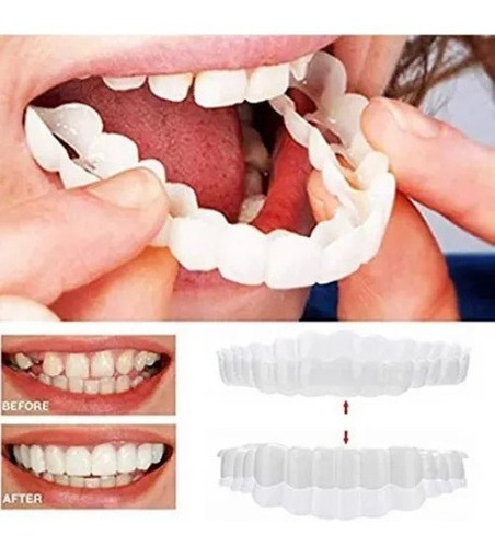 1 Par De Dentaduras Postizas Artificiales De Silicona