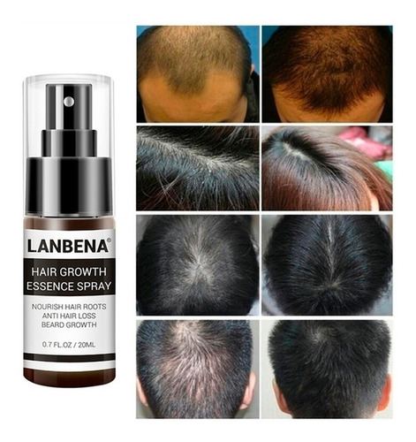 Lanbena Serum Crecimiento Cabello Alopecia Jengibre Ginseng