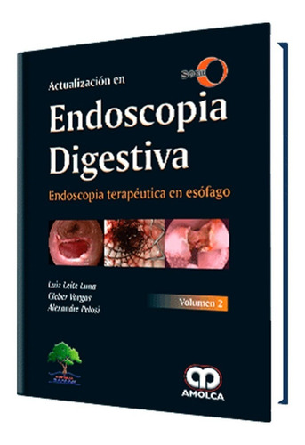 Endoscopia Digestiva. Endoscopia Terapéutica En Esófago. V2.