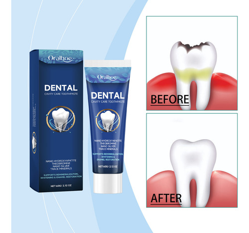 Purificación Dental Y Pasta De Dientes Para Caries Mainta 20