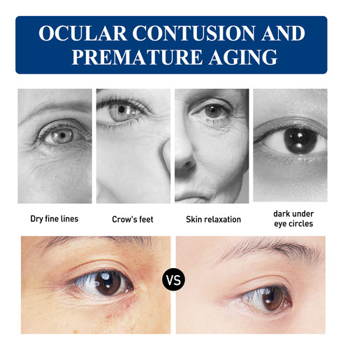 I La Crema For Ojos Con Colágeno Mejora Las Bolsas De Los