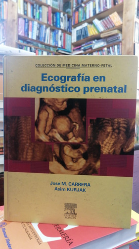 Ecografia En Diagnostico Prenatal
