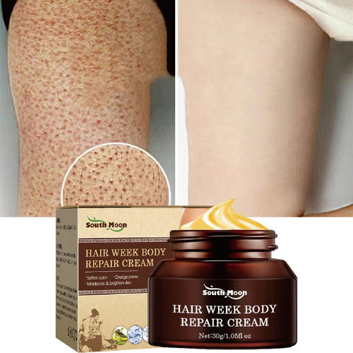 Crema De Tratamiento Reparador De Queratosis Pilaris Que Lim