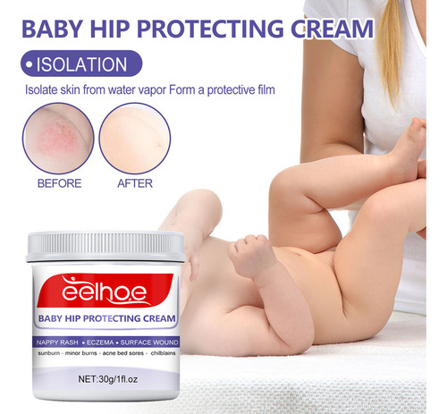 - Crema Curativa Antiseptic Burns More Sudocrem Cool Clean