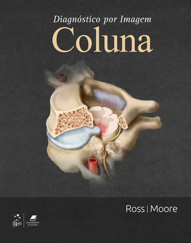 Diagnóstico por Imagem: Coluna, de Jeffrey S. Ross. Editorial GEN Guanabara Koogan, capa dura em português, 2018