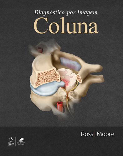 Diagnóstico por Imagem: Coluna, de Jeffrey S. Ross. Editora Gen – Grupo Editorial Nacional Part S/A, capa mole em português, 2018