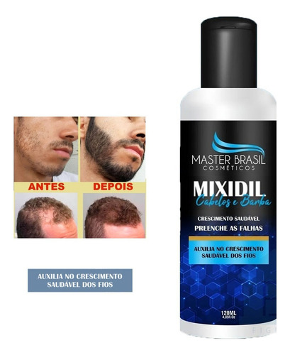 Diga Adeus A Calvície C/ Mixidil Resultado Garantido Kit 5