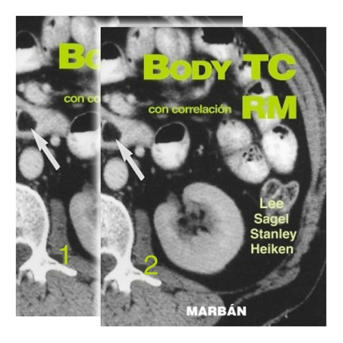 Lee Body Tc Correlacion Rm 2 Ts Libros Nuevos