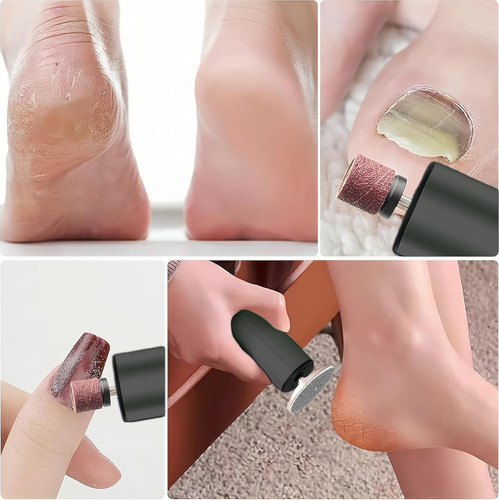 Recargable Removedor Callos Pedicure Exfoliante Lima Pies