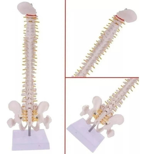 Modelo Anatómico De La Columna Vertebral (columna Vertebral)