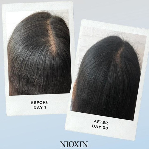 Nioxin Kit Anti Caída De 3 Pasos Sistema #4 300 Ml