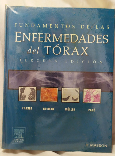 Enfermedades Del Torax Fraser Colman Muller Pare Ed. Masson