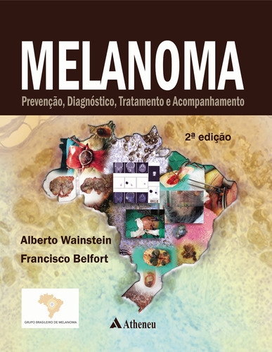 Melanoma - prevenção, diagnóstico, tratamento e acompanhamento, de Wainstein, Alberto. Editora Atheneu Ltda, capa dura em português, 2014