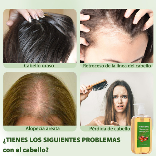 ChampĂș Batana, Crecimiento Del Cabello.