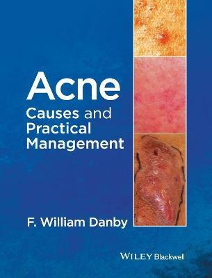 Libro Acne - F. William Danby