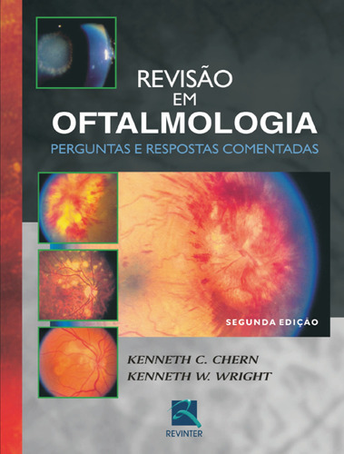 Revisão em Oftalmologia, de Chern, Kenneth C.. Editora Thieme Revinter Publicações Ltda, capa dura em português, 2007