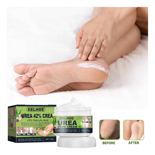 Creme De Ureia: Creme Para Mãos E Pés, Hidratante, Hidratant