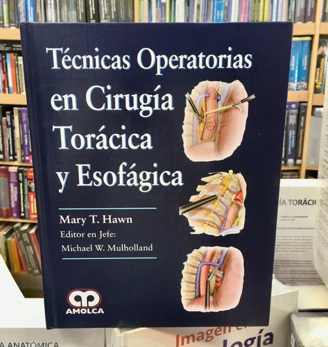 Técnicas Operatorias En Cirugía Torácica Y Esofágica