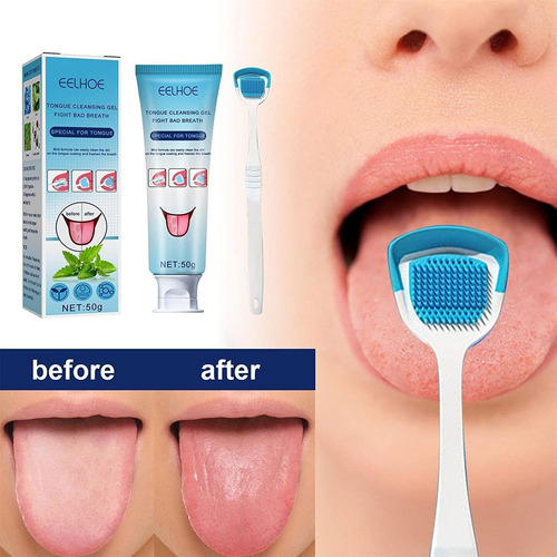 Limpieza De Lengua Set De Gel Limpiador De Lengua, Cepillo