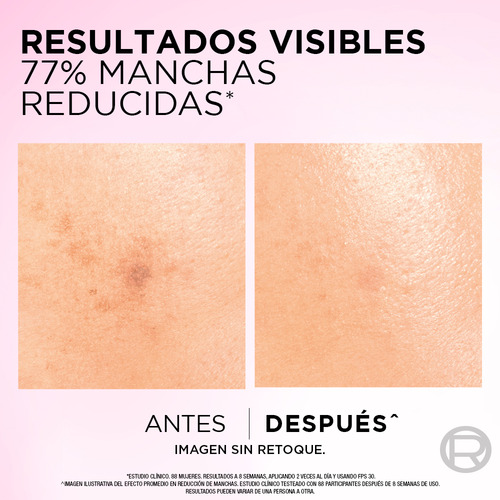 Gel Crema Noche Anti-manchas Ácido Glicólico L'oréal Paris Todo Tipo De Piel Noche