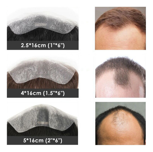 1.2x16cm Sistema Capilar Frontal De Cabello Natural