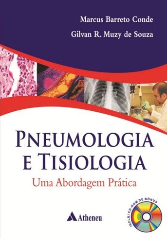 Pneumologia e tisiologia - Uma abordagem prática, de Muzy, Gilvan Renato. Editorial Editora Atheneu Ltda, capa mole em português, 2009