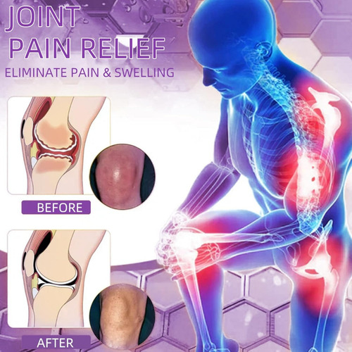 Z Gel De Masaje Lovilds Para Aliviar El Dolor Con Aceite De
