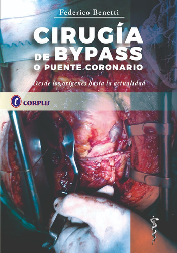 Cirugía De Bypass O Puente Coronario - Corpus