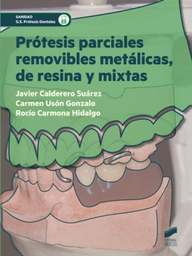 Prótesis Parciales Removibles Metálicas, De Resina Y Mixtas, De Francisco Javier Calderero Suárez. Editorial Síntesis, Tapa Blanda En Español