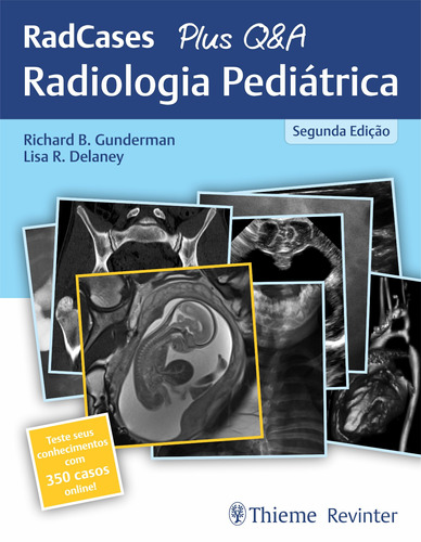 RedCases Plus Q&A Radiologia Pediátrica, de Gunderman, Richard B.. Editora Thieme Revinter Publicações Ltda, capa mole em português, 2019