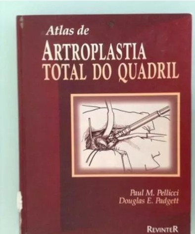 Atlas De Artroplastia Total Do Quadril
