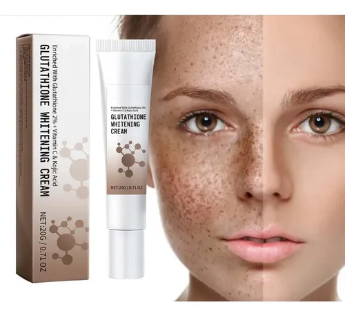 glutathione blanquea El Glutatión Las Manchas Que Se Desvanecen, Humecta Snow Caps Piel reducida importada
