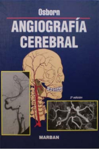 Angiografia Cerebral - Osborn - Marban