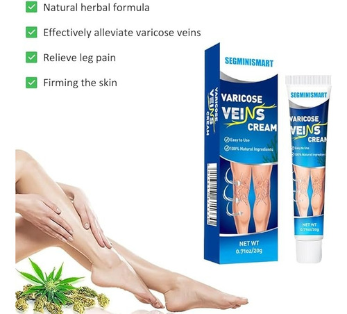 Crema Para Venas Varicosas