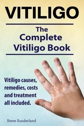 Vitiligo. Vitiligo Causes, Remedies, Costs And Treatment ...