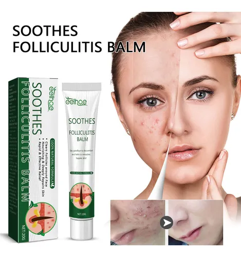 2×crema Hidratante Hidratante Para Eliminar La Foliculitis