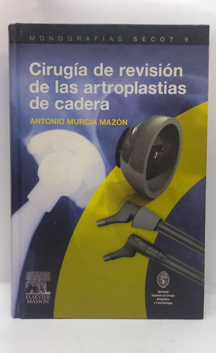 Cirugia De Revision De Las Artroplastias De Cadera