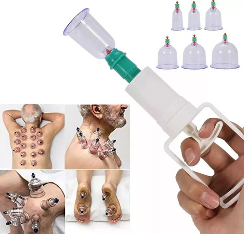 Kit Set 12 Ventosas Terapeuticas Desintoxicacion Neumaticas