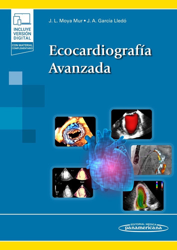 Ecocardiografía Avanzada + E-book - Moya Mur, José Luis  - *